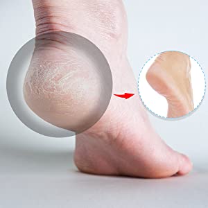 Pair of Silicone Heel Protector  Cheezstore